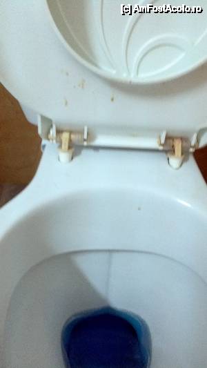 [P01] WC-ul din camera vecina, dezinfectat si curatat » foto by anca_sys
 - 
<span class="allrVoted glyphicon glyphicon-heart hidden" id="av472827"></span>
<a class="m-l-10 hidden" id="sv472827" onclick="voting_Foto_DelVot(,472827,2029)" role="button">șterge vot <span class="glyphicon glyphicon-remove"></span></a>
<a id="v9472827" class=" c-red"  onclick="voting_Foto_SetVot(472827)" role="button"><span class="glyphicon glyphicon-heart-empty"></span> <b>LIKE</b> = Votează poza</a> <img class="hidden"  id="f472827W9" src="/imagini/loader.gif" border="0" /><span class="AjErrMes hidden" id="e472827ErM"></span>