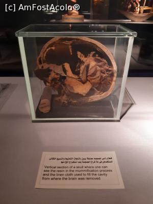 [P05] sectiune intr-un craniu mumificat » foto by roth
 - 
<span class="allrVoted glyphicon glyphicon-heart hidden" id="av1222784"></span>
<a class="m-l-10 hidden" id="sv1222784" onclick="voting_Foto_DelVot(,1222784,25858)" role="button">șterge vot <span class="glyphicon glyphicon-remove"></span></a>
<a id="v91222784" class=" c-red"  onclick="voting_Foto_SetVot(1222784)" role="button"><span class="glyphicon glyphicon-heart-empty"></span> <b>LIKE</b> = Votează poza</a> <img class="hidden"  id="f1222784W9" src="/imagini/loader.gif" border="0" /><span class="AjErrMes hidden" id="e1222784ErM"></span>